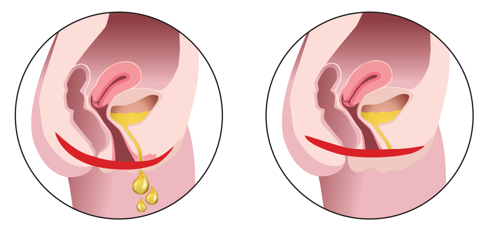 スターフォーマー・インティマウィーブ